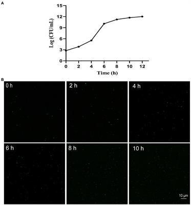 Rapid Determination of Antibiotic Resistance in Klebsiella pneumoniae by a Novel Antibiotic Susceptibility Testing Method Using SYBR Green I and Propidium Iodide Double Staining